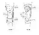 Fig. 02 - Electrical stimulation for orthopedic devices