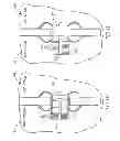 Fig. 06 - DEVICE AND METHOD FOR CONTROLLING IN-VIVO PRESSURE