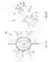 Fig. 08 - DEVICE AND METHOD FOR CONTROLLING IN-VIVO PRESSURE