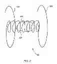 Fig. 09 - DEVICE AND METHOD FOR CONTROLLING IN-VIVO PRESSURE