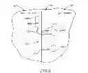Fig. 14 - DEVICE AND METHOD FOR CONTROLLING IN-VIVO PRESSURE