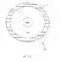Fig. 15 - DEVICE AND METHOD FOR CONTROLLING IN-VIVO PRESSURE