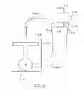 Fig. 17 - DEVICE AND METHOD FOR CONTROLLING IN-VIVO PRESSURE