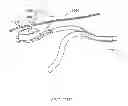 Fig. 19 - DEVICE AND METHOD FOR CONTROLLING IN-VIVO PRESSURE