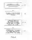 Fig. 23 - DEVICE AND METHOD FOR CONTROLLING IN-VIVO PRESSURE