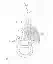 Fig. 01 - Surgical instrument and method for operations on the spinal column