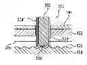 Fig. 01 - Catheter having a healing dummy