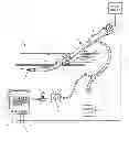 Fig. 01 - Anti-extravasation catheter