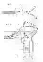 Fig. 05 - Anti-extravasation catheter
