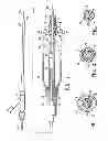 Fig. 02 - Catheter having transitioning shaft segments