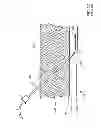 Fig. 03 - Medical guide element with diameter transition