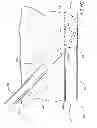Fig. 12 - Medical guide element with diameter transition