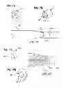 Fig. 13 - Medical guide element with diameter transition