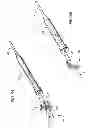 Fig. 14 - Medical guide element with diameter transition