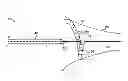 Fig. 01 - Lasso catheter with guide wire