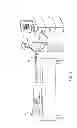Fig. 02 - Lasso catheter with guide wire