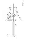 Fig. 04 - Lasso catheter with guide wire