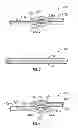 Fig. 04 - FIGURE MOULDING AND WEIGHT LOSS AID SYSTEMS AND METHODS