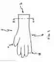 Fig. 02 - Hemostatic glove device and method for use of same