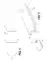 Fig. 02 - Wound Dressing