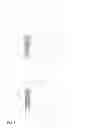Fig. 08 - Forced focused fastening member
