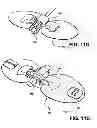 Fig. 09 - Catheter securement devices