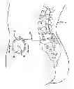 Fig. 01 - Dual plunger based systems and method for use in determining a volume in a reservoir