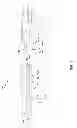 Fig. 02 - Adapter For A Feeding Tube
