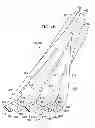 Fig. 10 - Adaptable wound drainage system