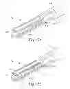 Fig. 12 - Bipolar electrosurgical features for targeted hemostasis
