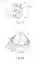 Fig. 20 - Bipolar electrosurgical features for targeted hemostasis