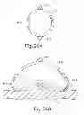 Fig. 22 - Bipolar electrosurgical features for targeted hemostasis