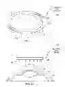 Fig. 02 - SYSTEM AND PROCEDURE FOR ENHANCING OCULAR DRAINAGE