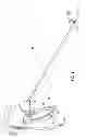 Fig. 02 - Dynamic and static bipolar electrical sealing and cutting device