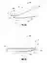 Fig. 07 - Thread-like knife for tissue cutting
