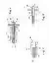 Fig. 05 - Instruments and method for preparing an intervertebral space for receiving an artificial disc implant