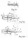 Fig. 06 - Instruments and method for preparing an intervertebral space for receiving an artificial disc implant