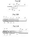 Fig. 09 - Instruments and method for preparing an intervertebral space for receiving an artificial disc implant