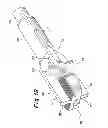 Fig. 10 - Instruments and method for preparing an intervertebral space for receiving an artificial disc implant
