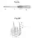 Fig. 13 - Instruments and method for preparing an intervertebral space for receiving an artificial disc implant