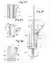 Fig. 16 - Instruments and method for preparing an intervertebral space for receiving an artificial disc implant