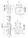 Fig. 19 - Instruments and method for preparing an intervertebral space for receiving an artificial disc implant