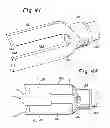 Fig. 20 - Instruments and method for preparing an intervertebral space for receiving an artificial disc implant