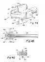 Fig. 22 - Instruments and method for preparing an intervertebral space for receiving an artificial disc implant