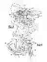 Fig. 05 - Patient-specific acetabular guide for anterior approach