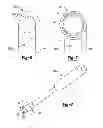 Fig. 07 - Patient-specific acetabular guide for anterior approach