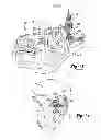 Fig. 11 - Patient-specific acetabular guide for anterior approach