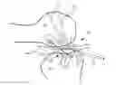 Fig. 01 - Anatomic femoral guide