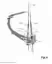 Fig. 07 - Anatomic femoral guide