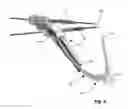 Fig. 09 - Anatomic femoral guide